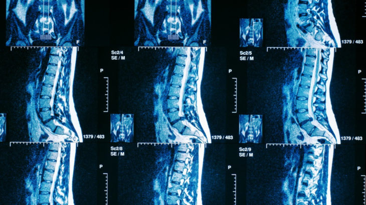 Рентген или МРТ позвоночника, что лучше и в чём отличия?