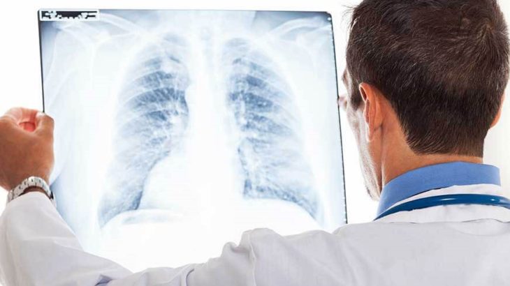 Рентген шейного отдела позвоночника — что показывает и как его делают