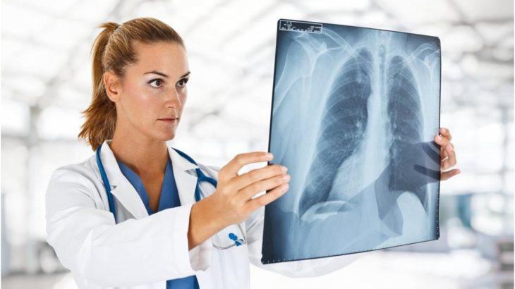 Что показывает рентген легких и как его делают