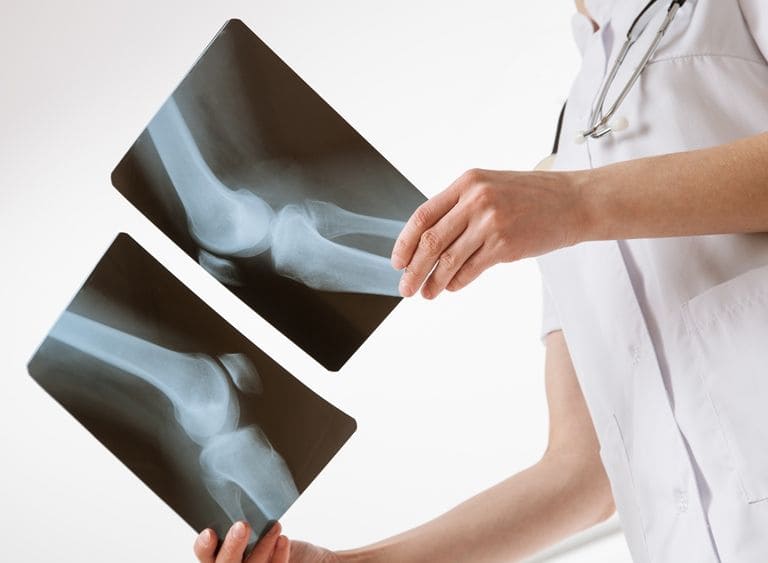 УЗИ коленного сустава или рентген - что лучше?