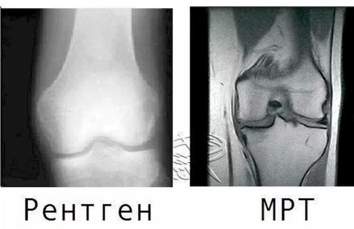 Отличие МРТ от снимка рентгенограммы
