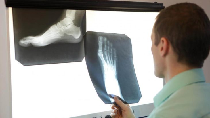 Как делается рентген стопы и что он показывает