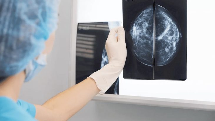 Отличие маммографии от УЗИ молочных желез
